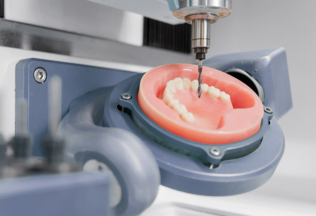 implantes dentales en Burgos