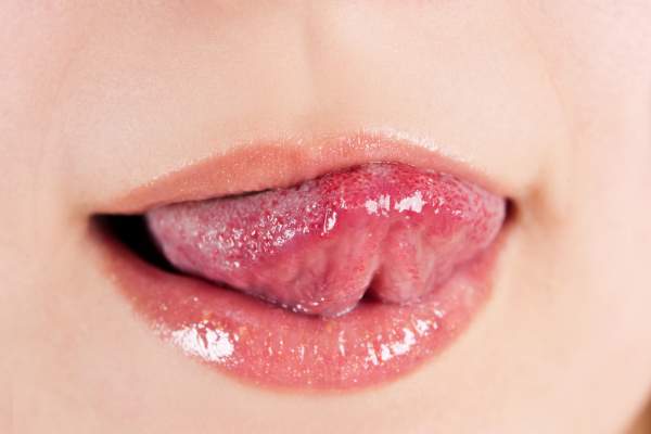 aliviar picor en la lengua